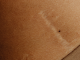 How do you remove a scar with a laser?